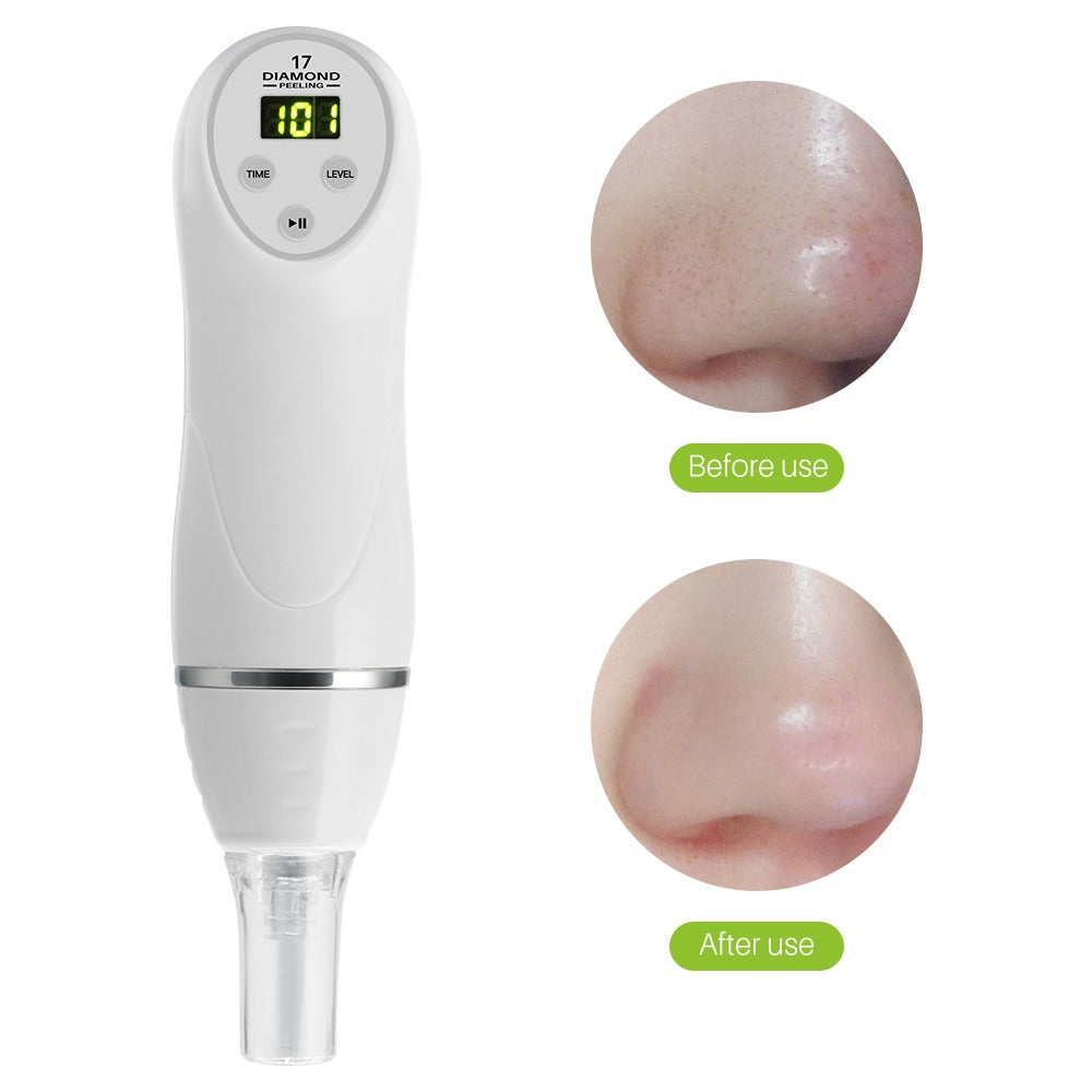 Diamond Microdermabrasion Blackhead Remover — 10-in-1 Suction & Skin Renewal