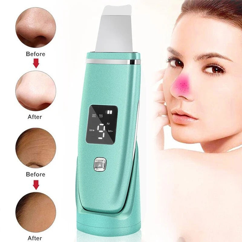 Ultrasonic Facial Skin Scrubber Pro — 7-in-1 Deep Cleansing & EMS Lifting