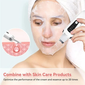 Ultrasonic Facial Skin Scrubber — 4 Modes, Deep Cleansing & Anti-Acne
