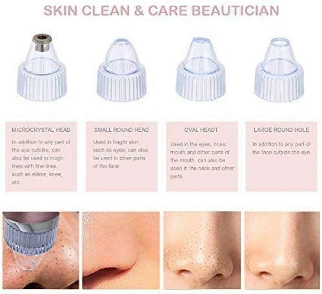 Blackhead Remover Pore Vacuum Cleaner — 5 Suction Levels & 4 Probes