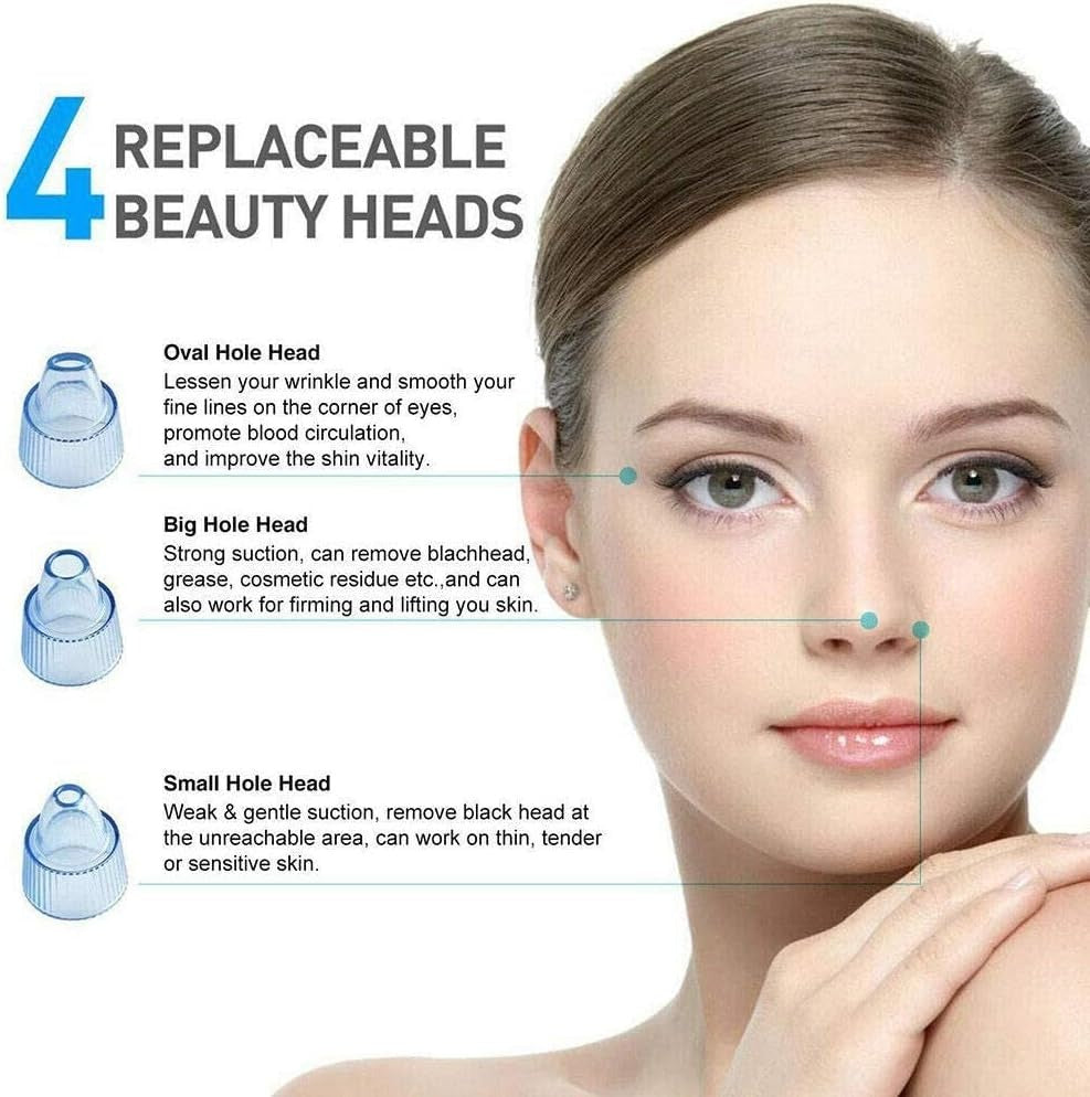 Blackhead Remover Pore Vacuum Cleaner — 5 Suction Levels & 4 Probes