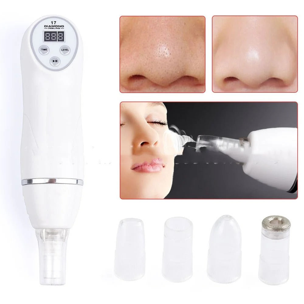 Diamond Microdermabrasion Blackhead Remover — 10-in-1 Suction & Skin Renewal